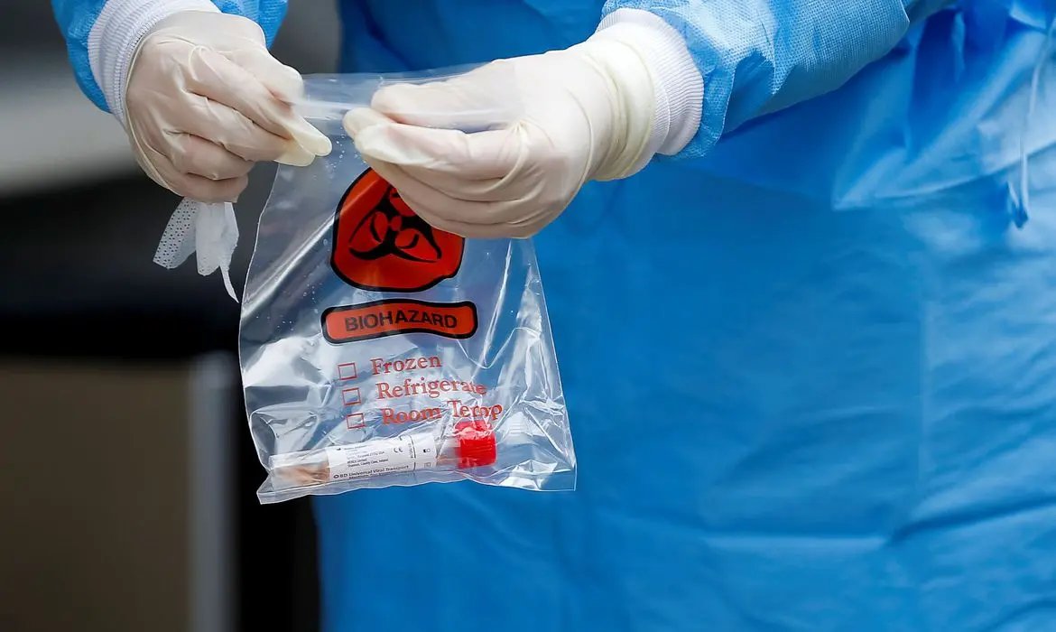500 mil kits de teste r&aacute;pido chegam ao Brasil