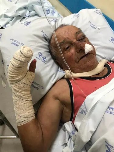 Idoso &eacute; atingido por pedras na cabe&ccedil;a em assalto