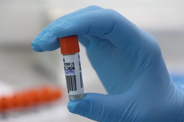 Lacen realiza mais de 405 mil testes RT-PCR em 2020