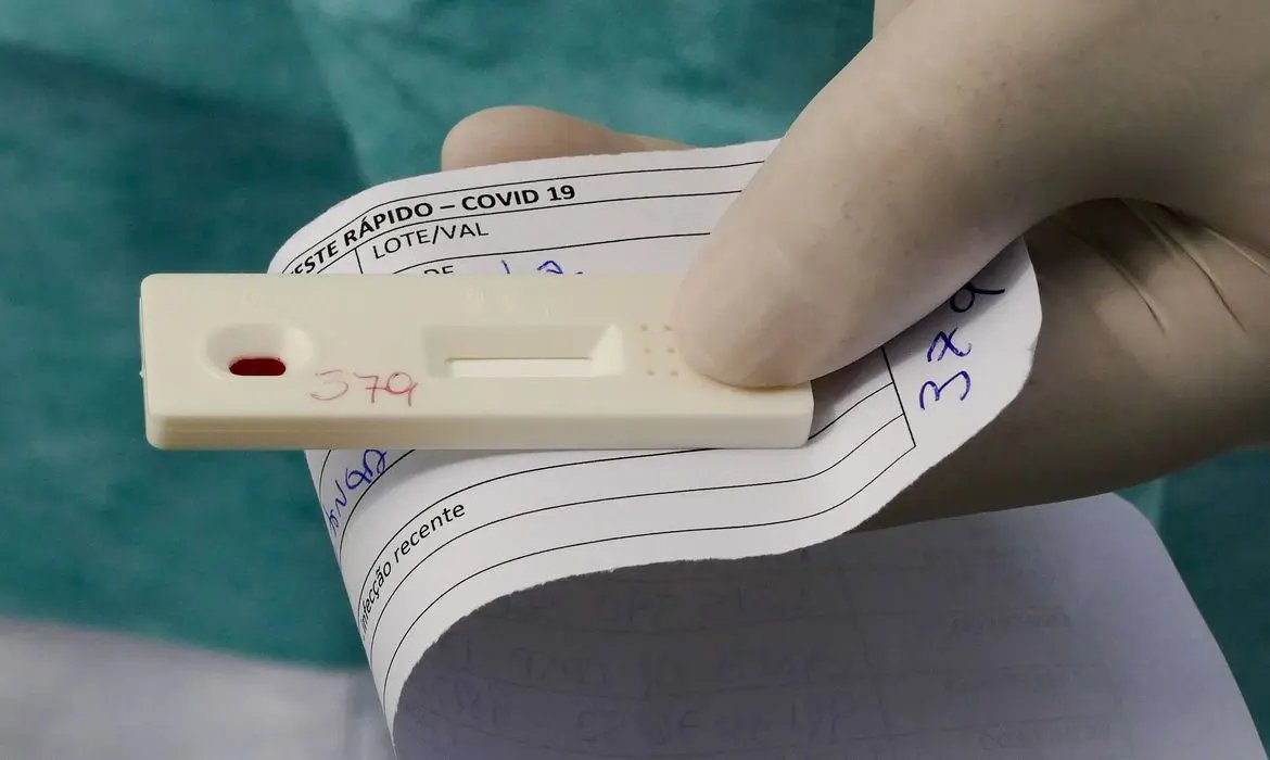 Brasil registra 58.428 novos infectados por covid-19 em 24 horas