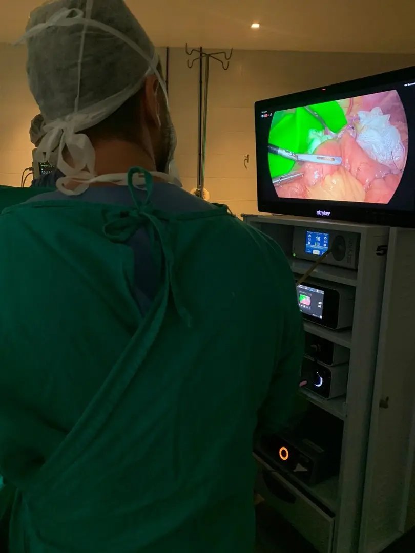 Primeira gastrectomia total por videolaparoscopia &eacute; realizada no Hospital Azambuja