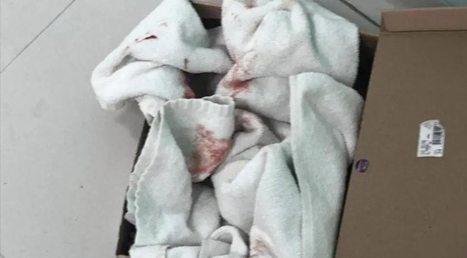 Duas pessoas s&atilde;o investigadas por abandonar beb&ecirc; na lixeira