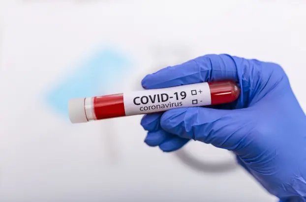 Buscas por consultas e testes de Covid-19 v&ecirc;m reduzindo em Brusque