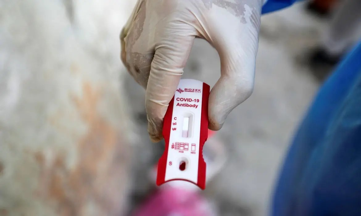 Indeniza&ccedil;&atilde;o a profissional incapacitado pela Covid-19 dever&aacute; ser de R$ 50 mil