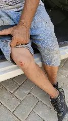 Idoso passa mal no carro e atinge poste em Brusque  - 2