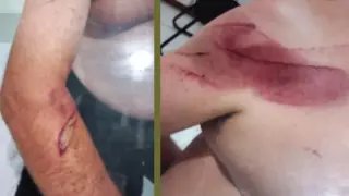 Patrão e ex-funcionário brigam de facão após provocações em Nova Trento  - 1