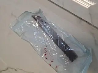 Imagem chocante: polícia divulga raio-x de faca na cabeça de mulher - 1