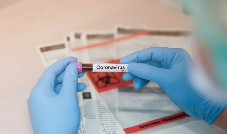 Santa Catarina tem 164 casos confirmados de Coronav&iacute;rus