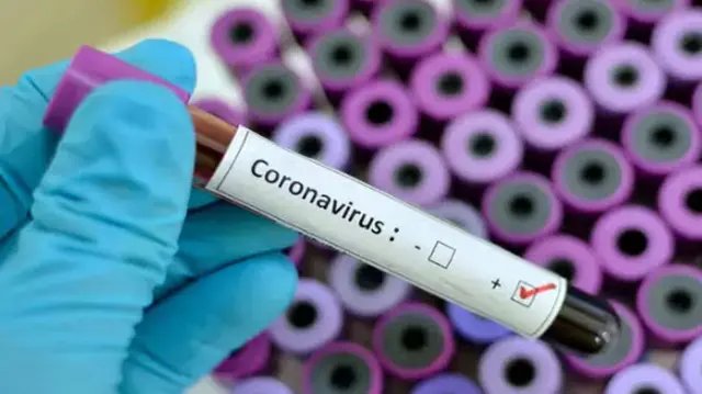 Sobe para 20 casos confirmados de Coronav&iacute;rus em SC