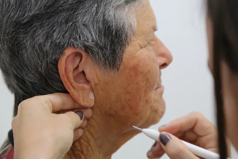 Guabiruba oferece auriculoterapia na rede pública de saúde