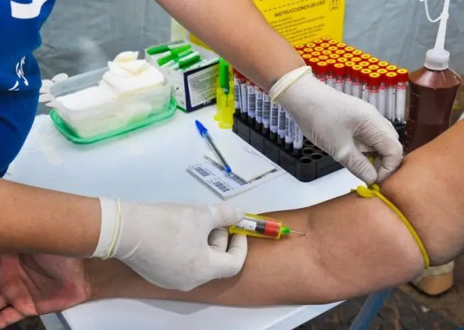 Menos da metade dos infectados por HIV e tuberculose tomam antirretroviral