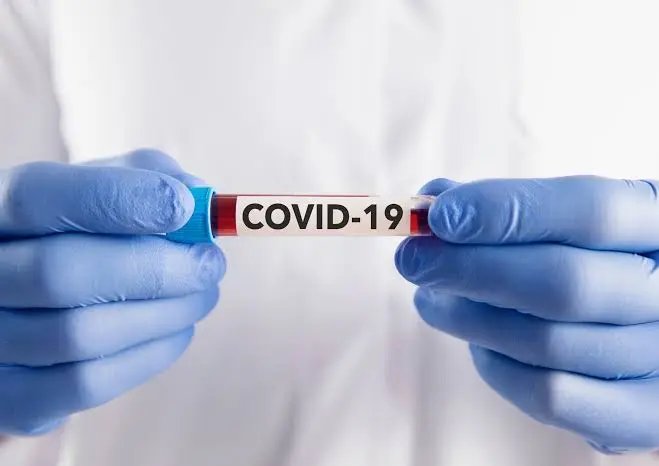 Covid-19: Boletim epidemiol&oacute;gico semanal atualiza n&uacute;meros