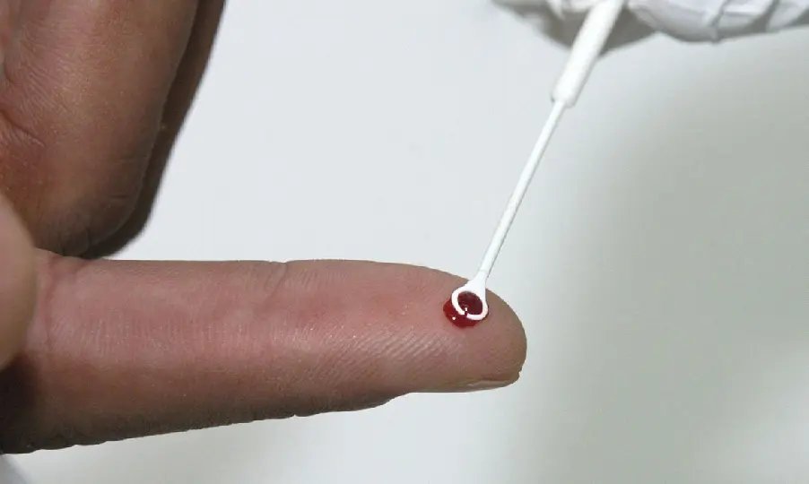 Estudo mostra resist&ecirc;ncia de muta&ccedil;&atilde;o a rem&eacute;dio usado no Brasil