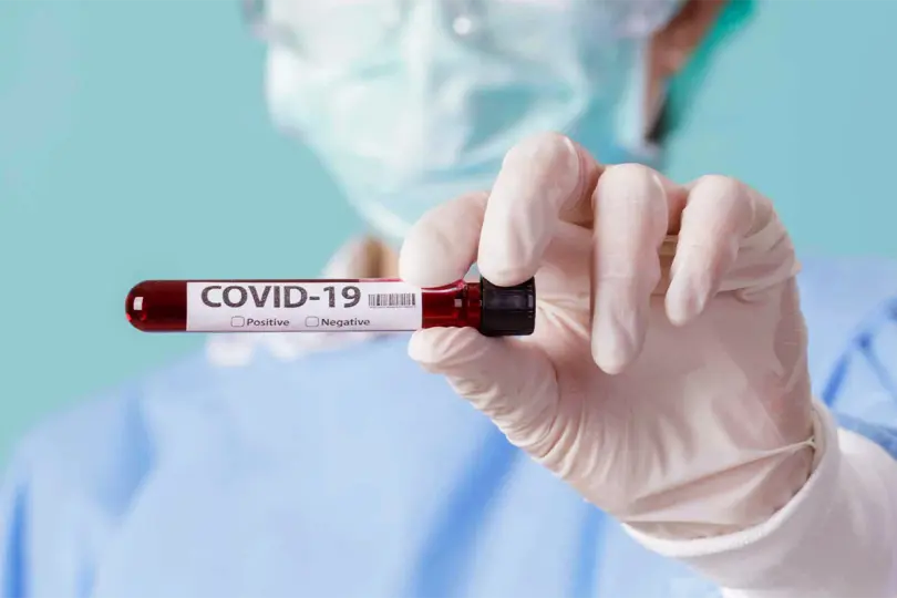 Nas &uacute;ltimas 24 horas foram registrados 37 novos casos de Covid-19, em Brusque