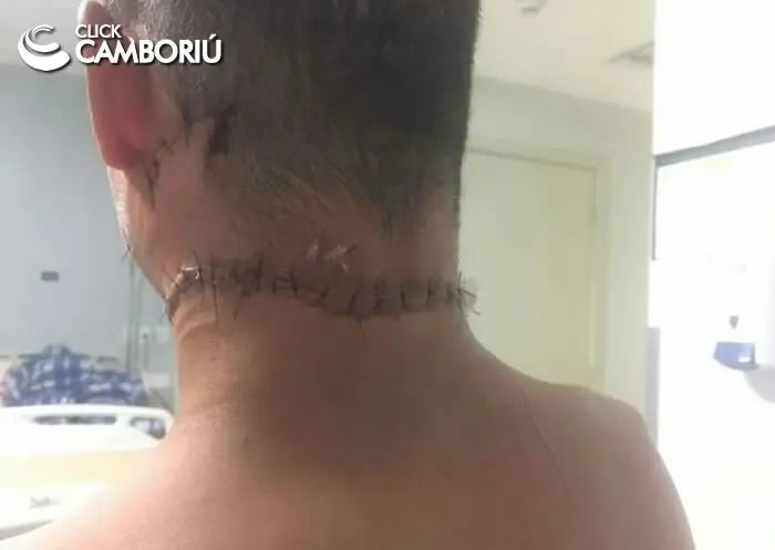 Jovem que quase foi decapitado está vivo