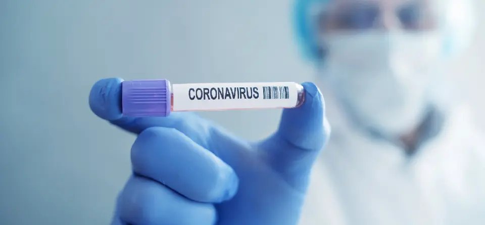 Nas &uacute;ltimas 24 horas Brusque registra 167 novos casos de Covid-19