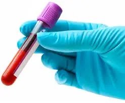 Doação de sangue para medula óssea está suspensa em SC