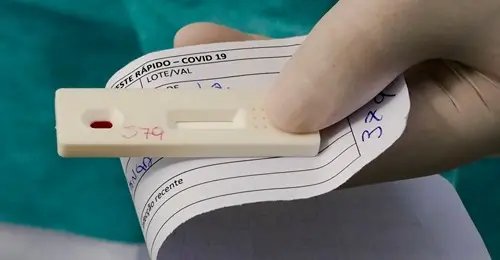 Brasil registra 354 novas mortes por Covid-19 e mais de 34 mil novos casos em 24h