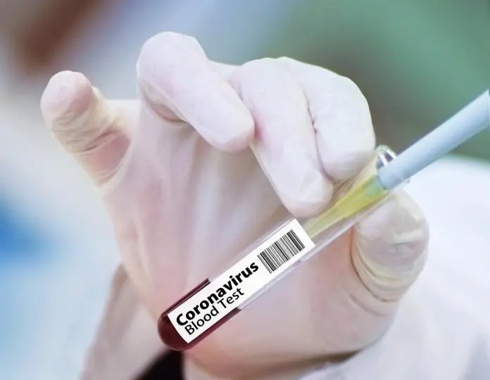 Guabiruba passa de 500 casos confirmados de covid-19