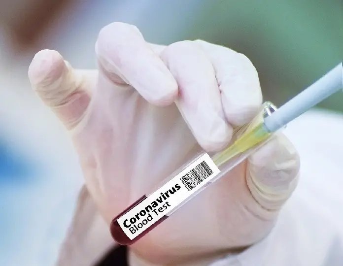 Santa Catarina vai testar vacina da P&oacute;lio contra Covid-19