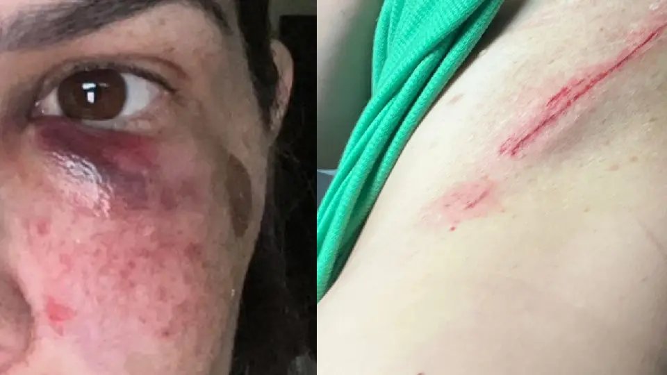 (VIDEO) Mãe de aluna é agredida na porta da escola em Brusque 