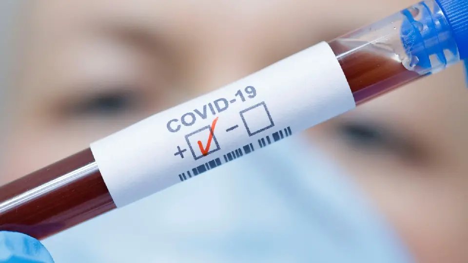 Brusque registra quase 700 casos de Covid-19 em 2024