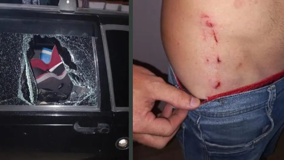 Homem é agredido com barra de alumínio após discussão com ex-mulher