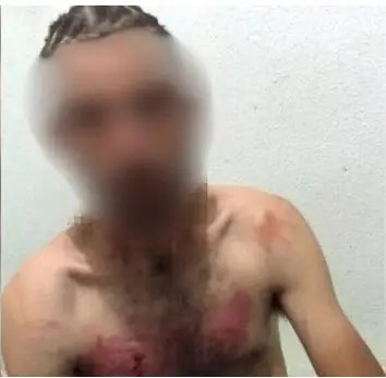 Suspeito de tortura contra deficiente é preso
