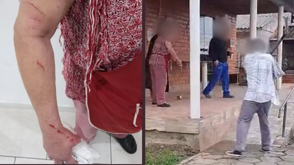 Mulher é ferida ao tentar proteger o filho de golpe de foice