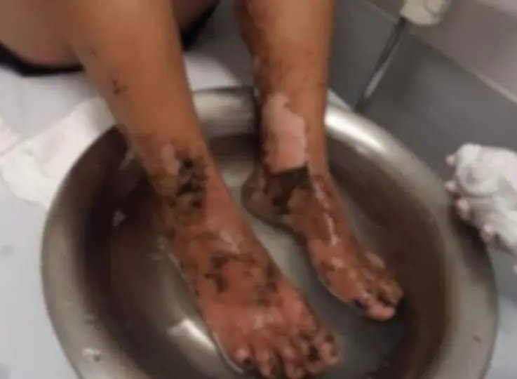 Homem é preso após arremessar esposa e sogra ao fogo