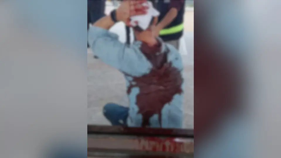 Briga termina com um levando garrafada na cabeça