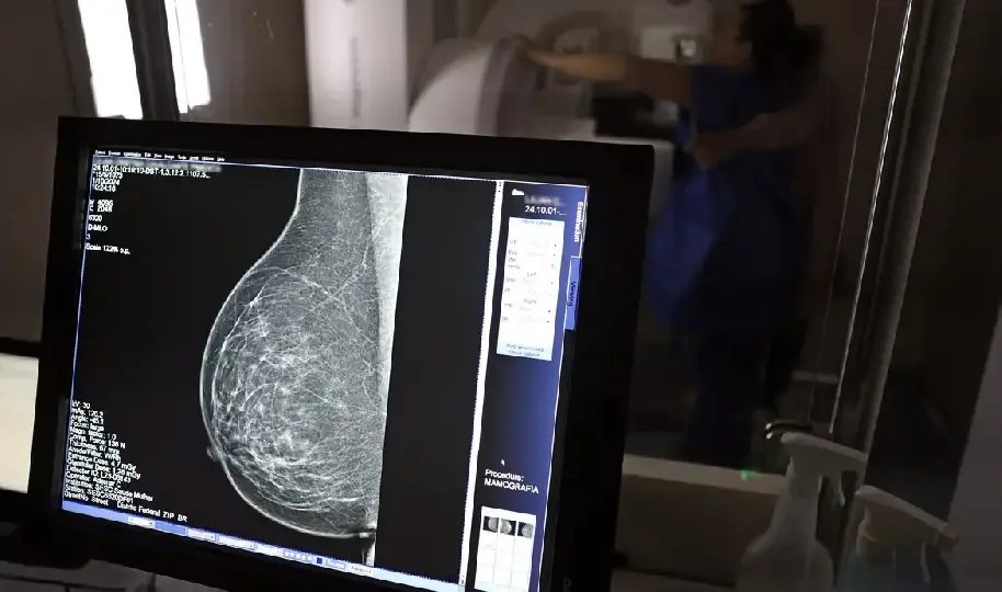 SUS passa a oferecer mamografia para mulheres a partir dos 40 anos