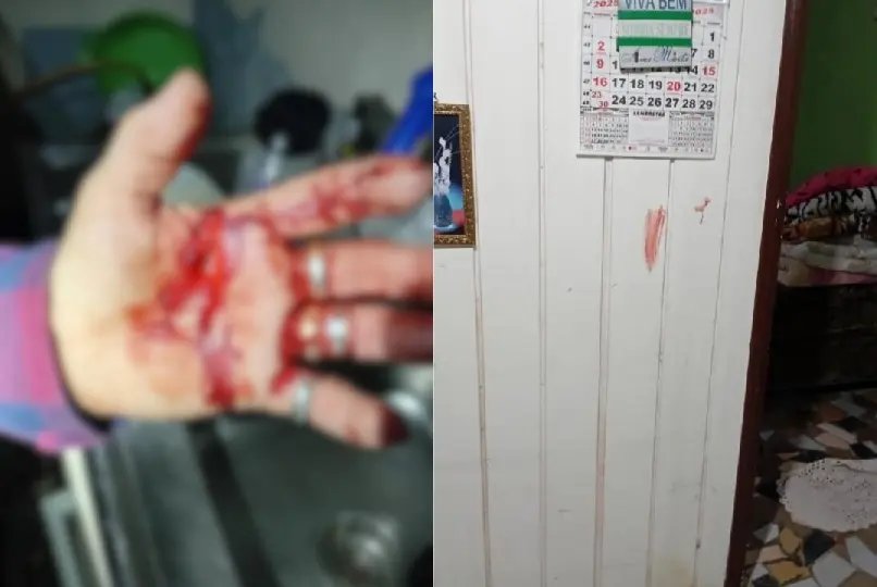 Mulher sofre corte na mão ao se defender de ataque com faca