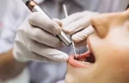 Dentista que perdeu broca na boca de paciente terá que indenizar vítima
